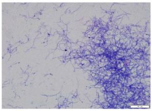 Figure 3. Modified Kinyoun stain demonstrating non-acid fast staining bacilli. Magnification 1000×.